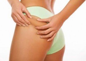 Cellulite: l' esame che precede la mesoterapia omeopatica